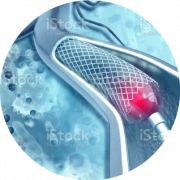 Neurocirugía y Terapia Endovascular Neurológica